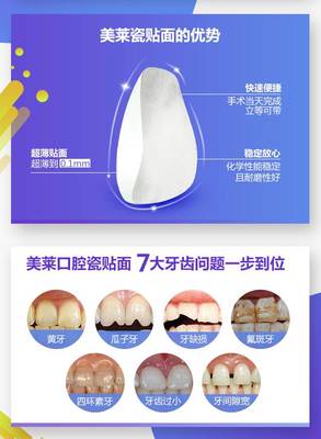 瓷贴面 开启您的亮白眼妆新纪元——长沙流行款超博3D贴面推荐